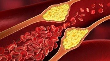 Trigliseridler: Neden Önemlidir?